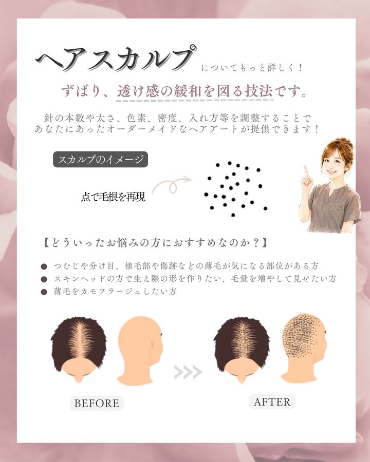 ヘアスカルプアートメイク 症例写真（香川県）