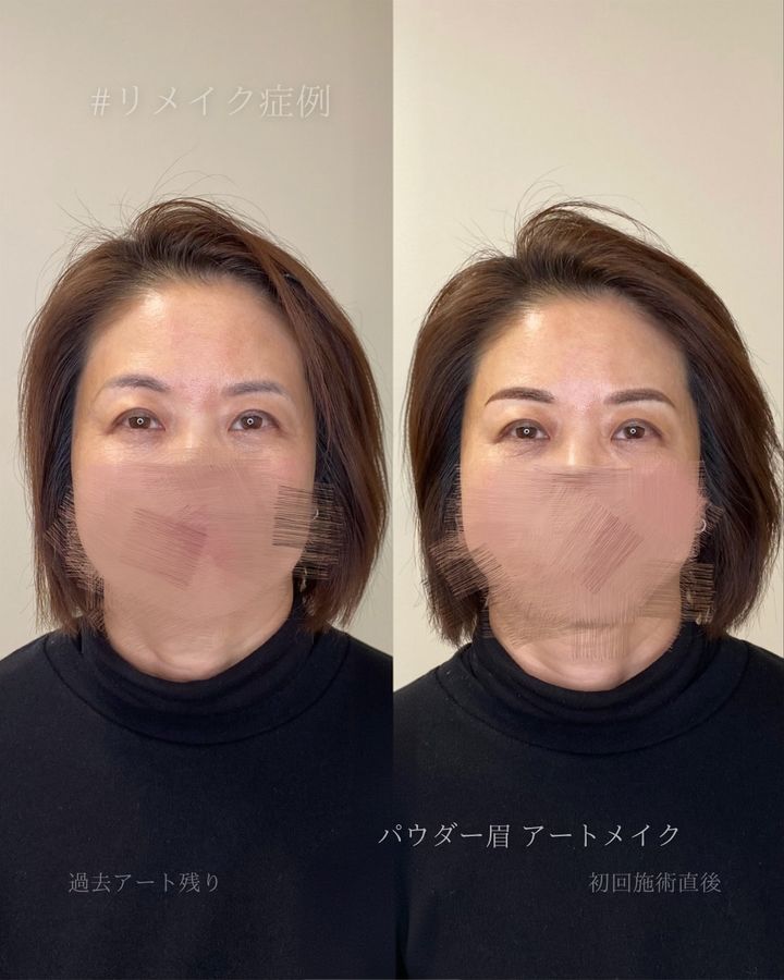 パウダー眉アートメイク 症例写真（群馬県）
