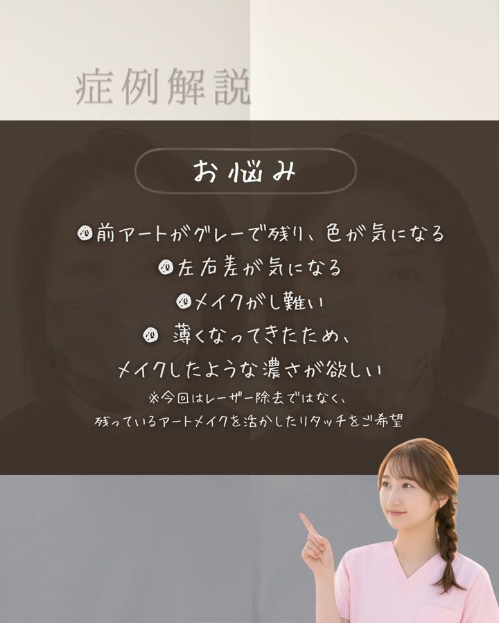 パウダー眉アートメイク 症例写真（群馬県）