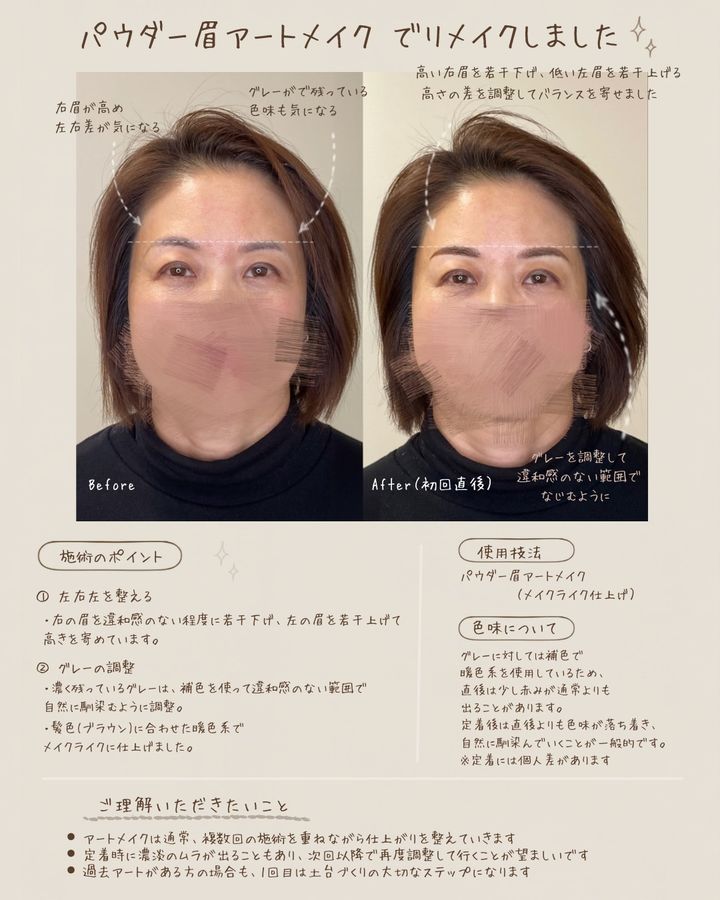 パウダー眉アートメイク 症例写真（群馬県）