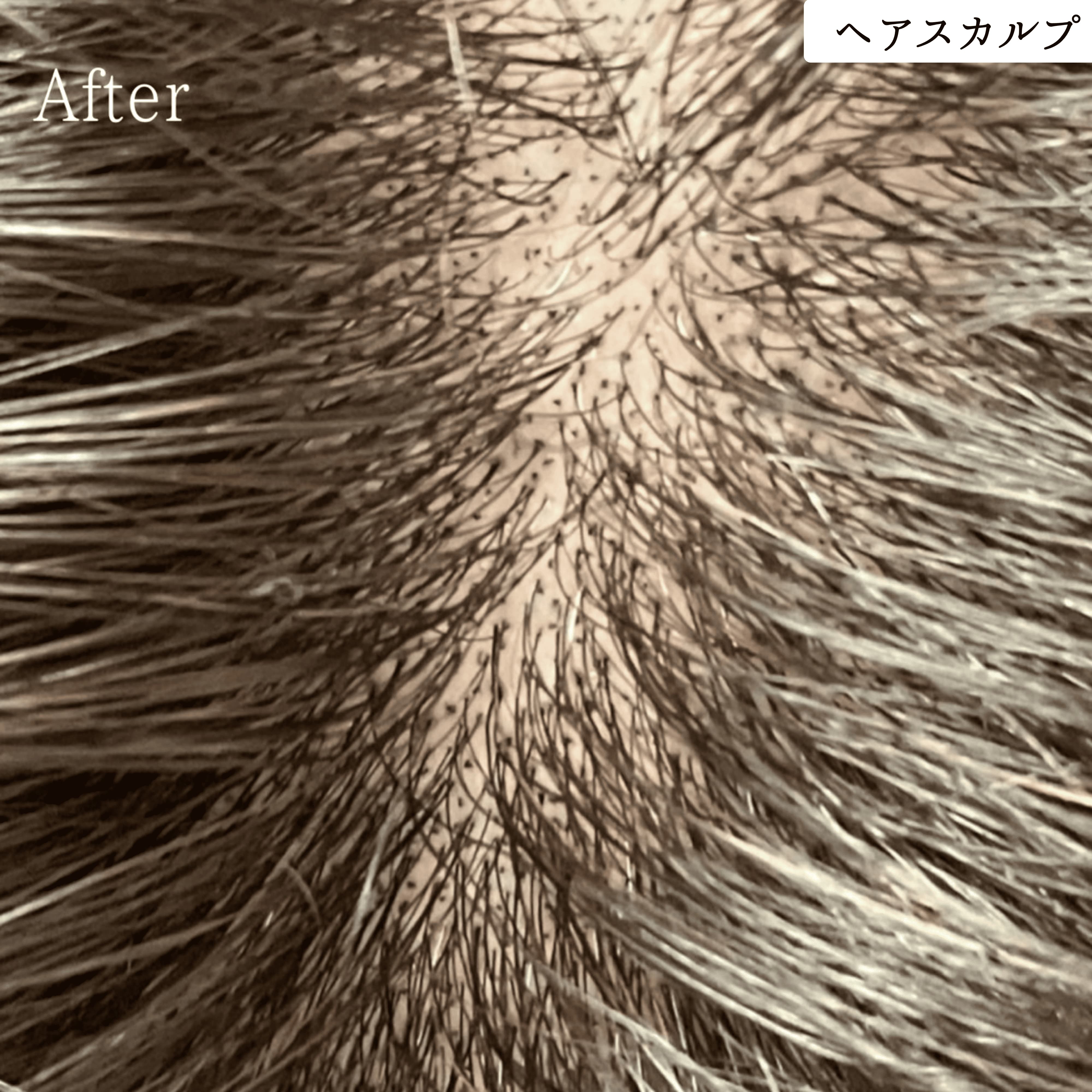 ヘアスカルプアートメイク 症例｜東京・半蔵門 komi