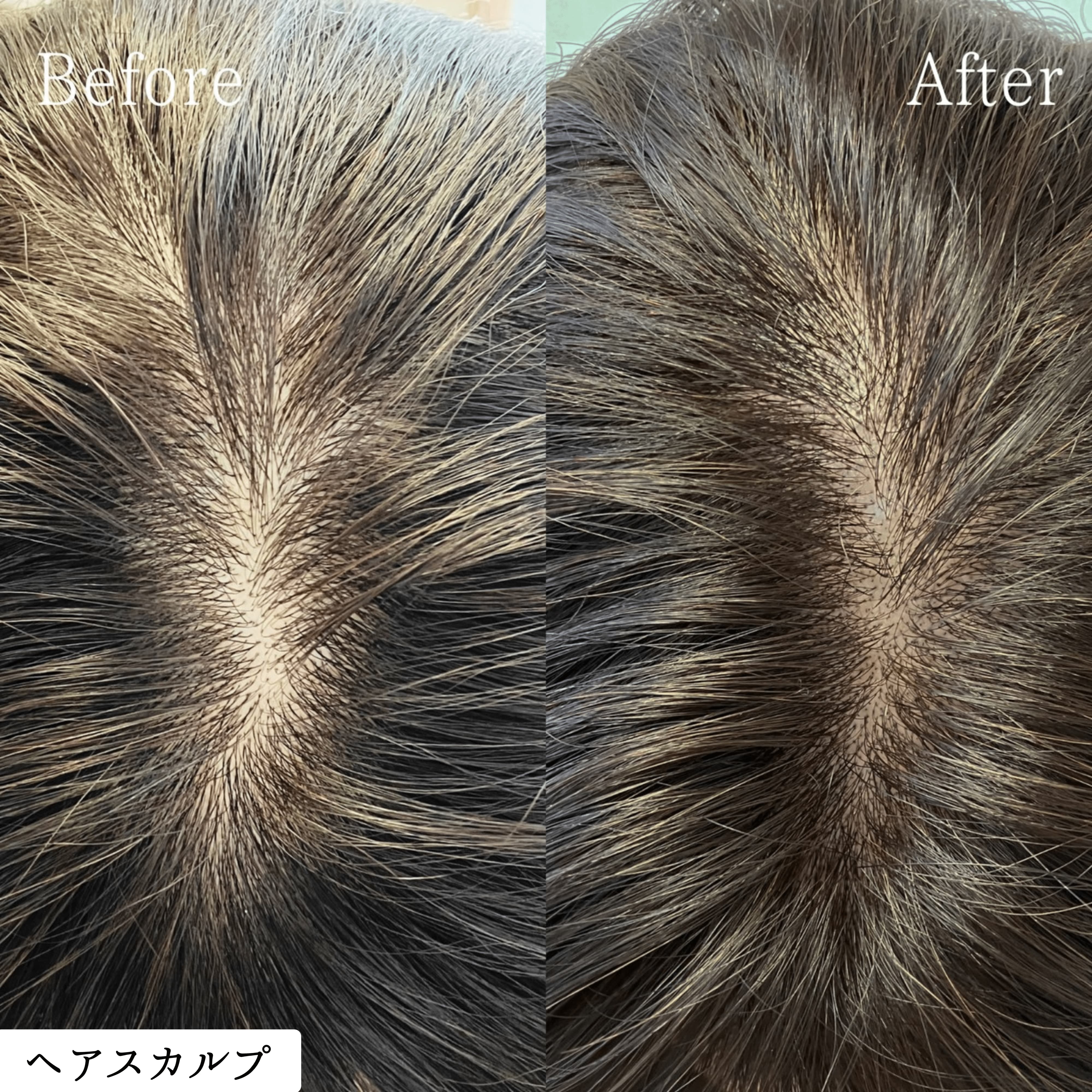 ヘアスカルプアートメイク 症例｜東京・半蔵門 komi