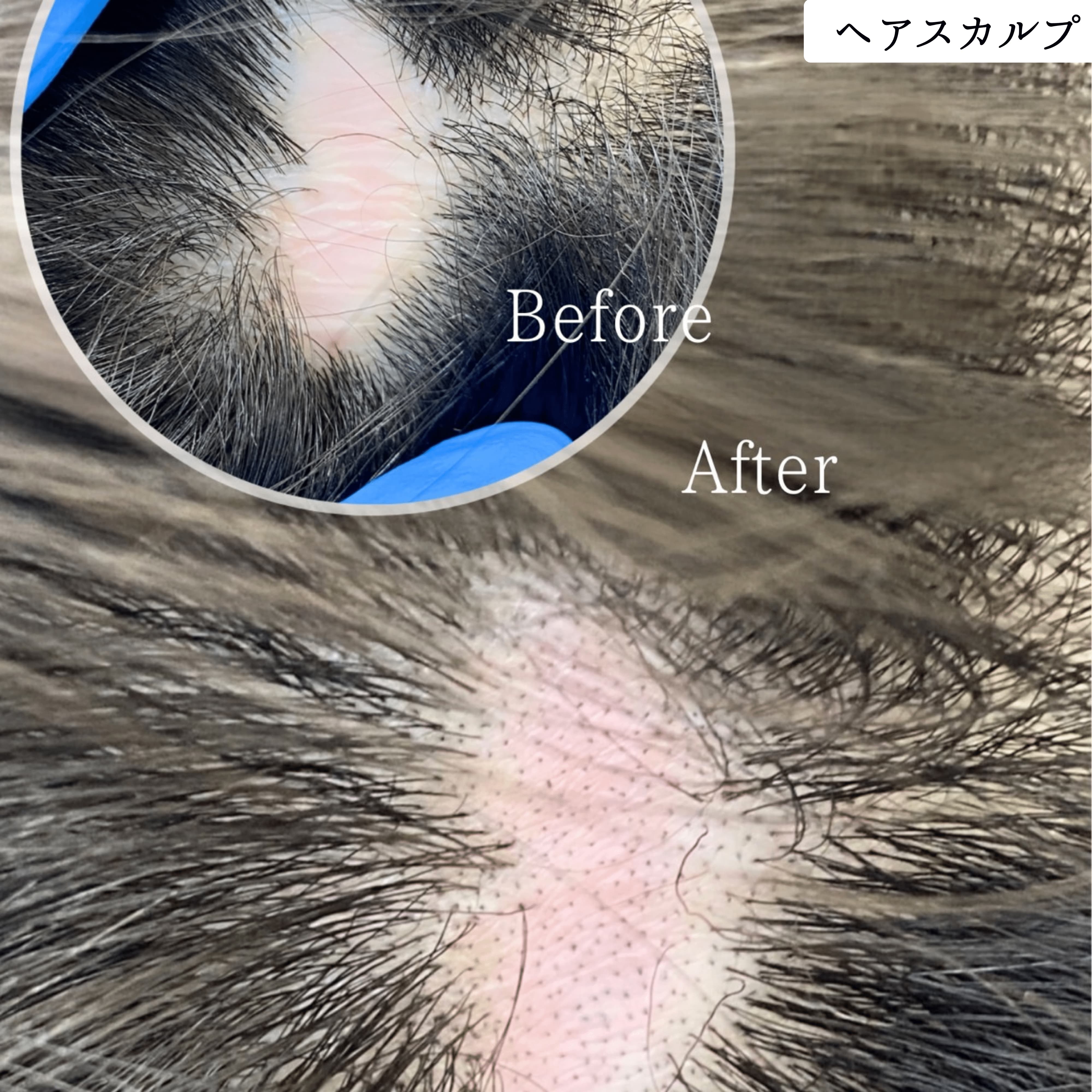 ヘアスカルプアートメイク 症例｜東京・半蔵門 komi